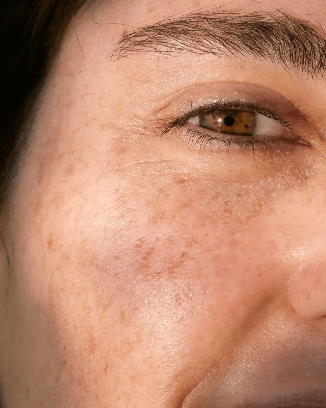 First 8 Weeks on Prescription Skincare skin texture image for Prescription Skin