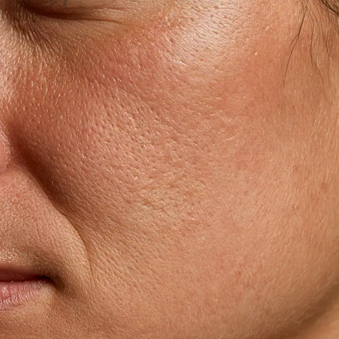 Macro close-up of clear cheek skin with fine pores and soft texture, illustrating cleanser use